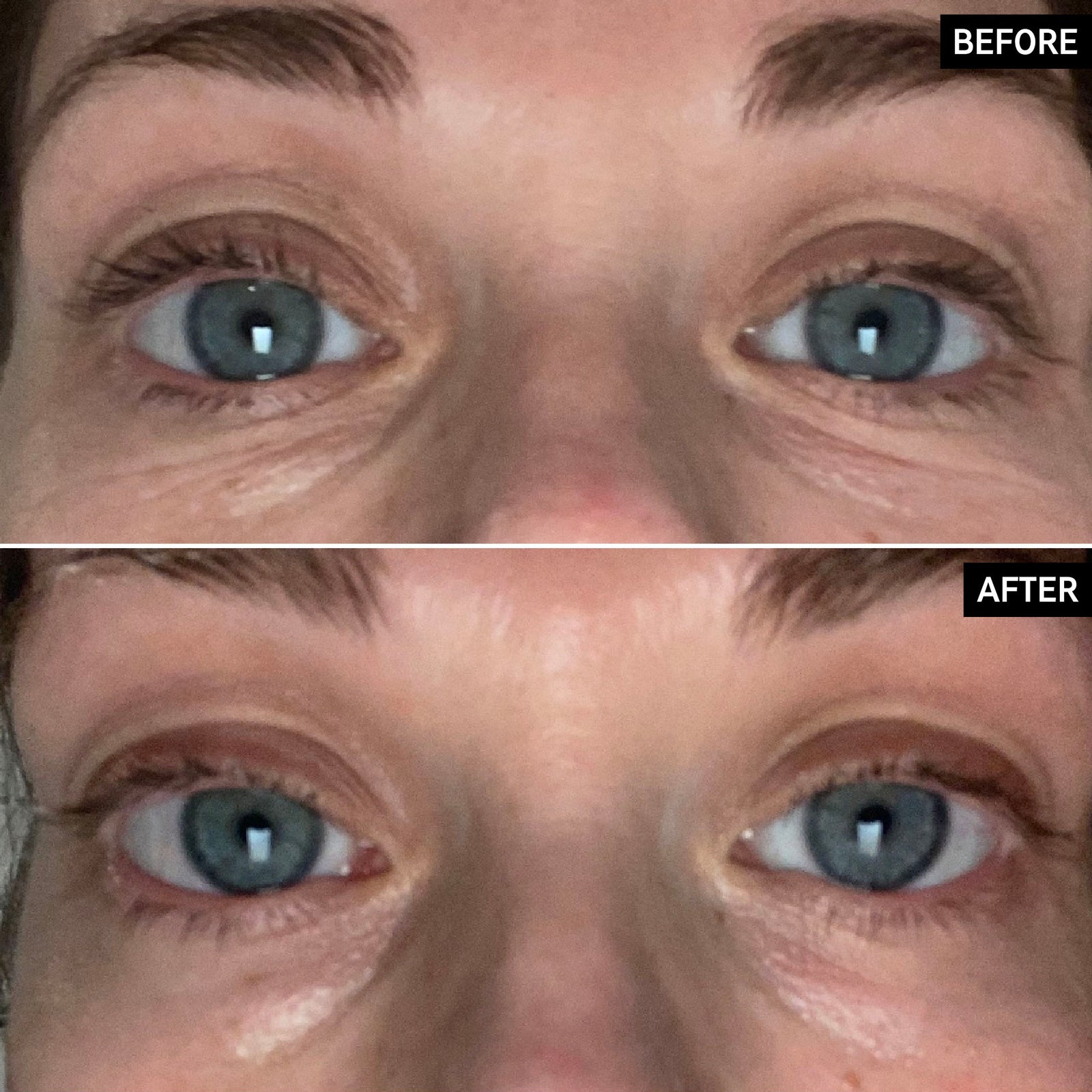 Retinol Eye Cream before and after results